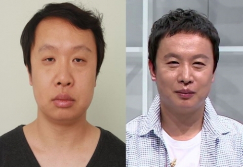 성형과 모발 관리를 통해 훈남으로 변신한 개그맨 한극수 씨의 모습