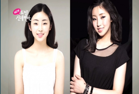 김소영 씨가 신데렐라성형외과에서 성형수술 후 연예인같은 변신으로 화제를 모으고 있다.