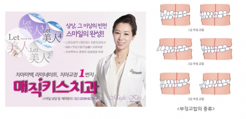 치아교정 상담을 무료로 진행중이다.