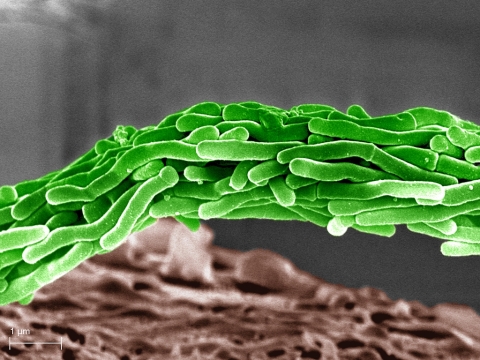 Dyed magnification of tuberculosis bacteria (Photo: Business Wire)
