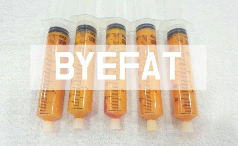지방추출주사 바이팻