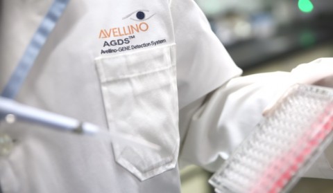 아벨리노 그룹이 최첨단 유전자 검사기술을 활용한 원추각막 유전자 검사를 2017년 초 출시한다