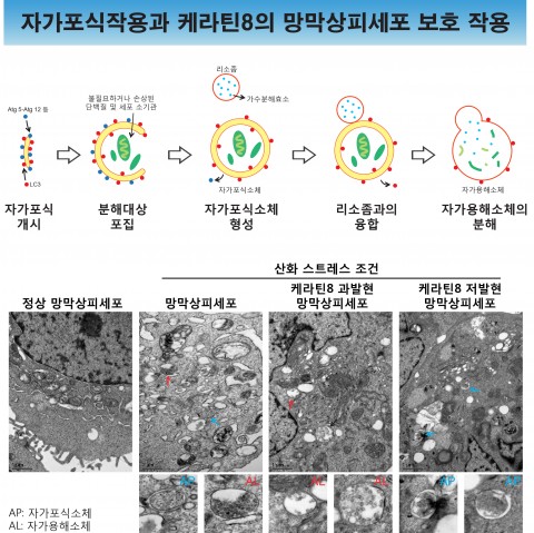 건국대학교 김동은 교수와 건국대병원 안과 정혜원 교수 연구팀이 중장년층 이상 노인 실명의 주된 원인으로 꼽히는 노년황반변성의 병리 기전을 밝혀냈다