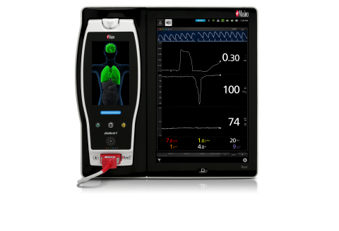 Radical-7®과 ORi™를 탑재한 Masimo Root®