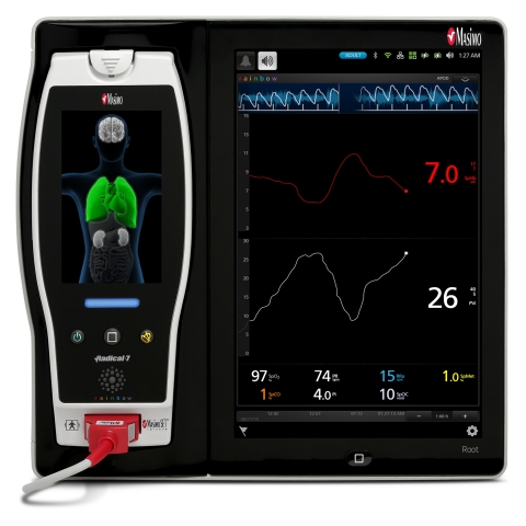 Study Investigates the Ability of Continuous Noninvasive Hemoglobin Monitoring with Masimo SpHb® to ...