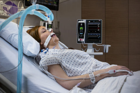 Masimo Announces CE Marking of Radius Capnography™ for the Root® Patient Monitoring and Connectivity...