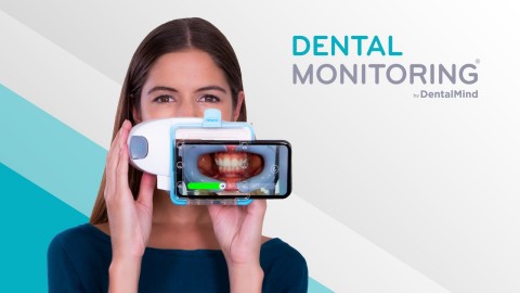 Photo Monitoring Light And SmileMate Virtual Consultation