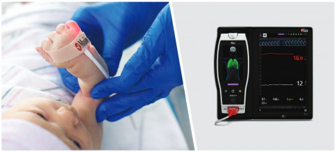 SpHb®를 탑재한 마시모 Root