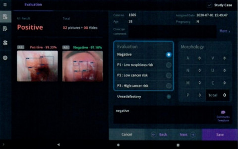 인공지능 기반 자궁경부암 의료영상 보조 진단소프트웨어