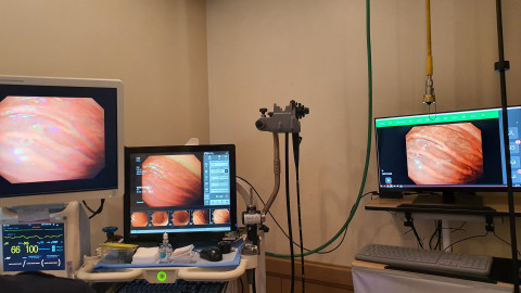 위내시경실에 공급된 인공지능 실시간 병변추적 시스템