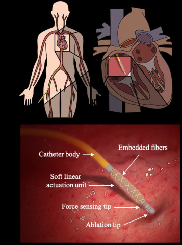 초소형 유연 구동기 및 촉각 센서가 장착된 카테터 시술 모식도
