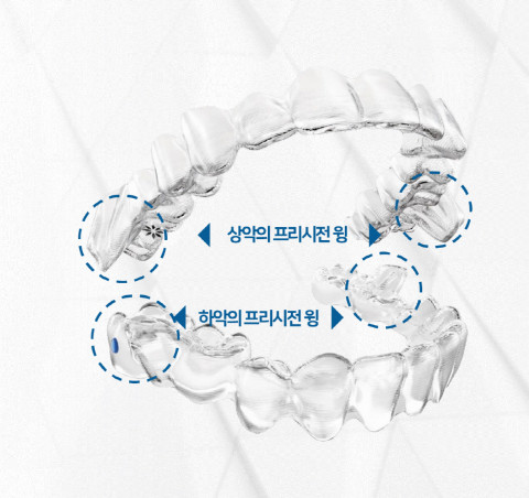 인비절라인이 ‘MA(Mandibular Advancement, 맨디뷸러 어드밴스먼트)’를 출시했다