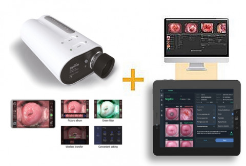 인공지능 기반 자궁경부암 스크리닝 시스템 ‘써비레이(Cerviray)’