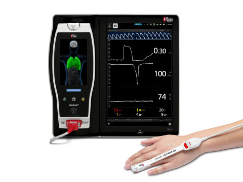ORi™를 부착한 마시모 Root®