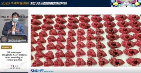 대한3D프린팅융합의료학회에서 소개된 글룩메디컬의 3D프린팅 심장 수술 시뮬레이터