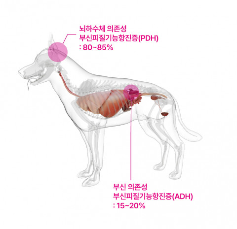 쿠싱증후군 종류