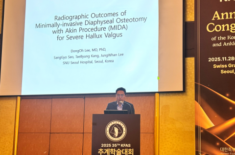 SNU서울병원 족부전담팀(서상교 대표원장, 이동오 원장, 강태병 원장, 이정환 원장)이 ‘2025년 제35차 대한족부족관절학회 추계학술대회’에서 최소침습 무지외반증 수술 관련 최신