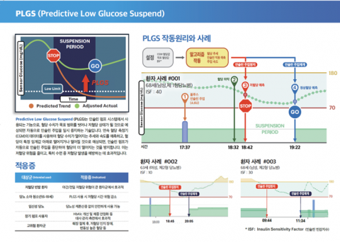 ‘저혈당 예측 기반 인슐린 주입 정지 기술(Predictive Low Glucose Suspend, PLGS)’은 인슐린 펌프 시스템에서 사용되는 기능으로, 혈당 수치가 목표 범위
