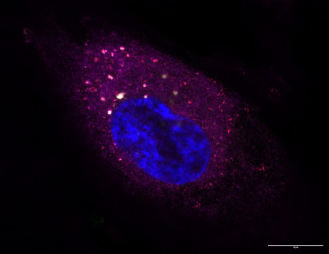 BK virus infected human kidney epithelial cell
