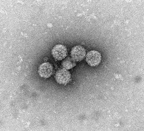 Electron microscope image of BK virus, showing the VP1 capsid protein that creates an icosahedral sh