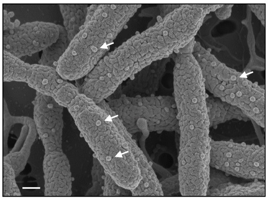 해양세균 유래 세포외입자의 형태(화살표) 세포외입자는 20~1,000nm의 크기를 가지는 인지질 이중막으로 둘러싸인 입자로 숙주세포, 크기, 구성 물질에 따라 membrane vesicles, outer membrane vesicles, exosomes, extosomes, microvesicles, extracellular vesilces 등의 약 30가지로 명명되어지고 있다