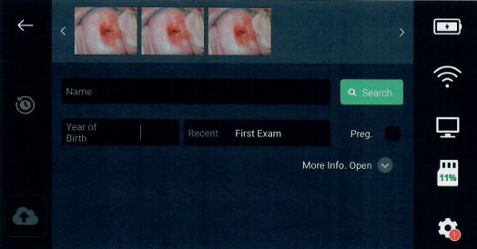 인공지능 기반 자궁경부암 의료영상 보조 진단소프트웨어