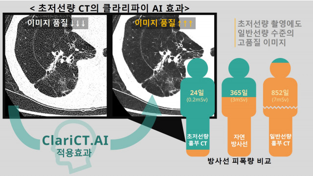 초저선량 흉부 CT, 자연 방사선, 일반선량 흉부 CT의 피폭량 비교 자료 및 초저선량 흉부 CT 촬영 이미지의 ClariCT.AI를 적용해 잡음 제거로 이미지 품질을 올린 전후 비교