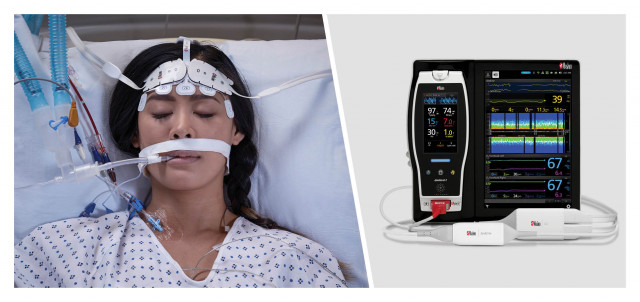 Study Investigates the Ability of Masimo O3® to Aid in Monitoring Septic Shock ICU Patients and Pred...