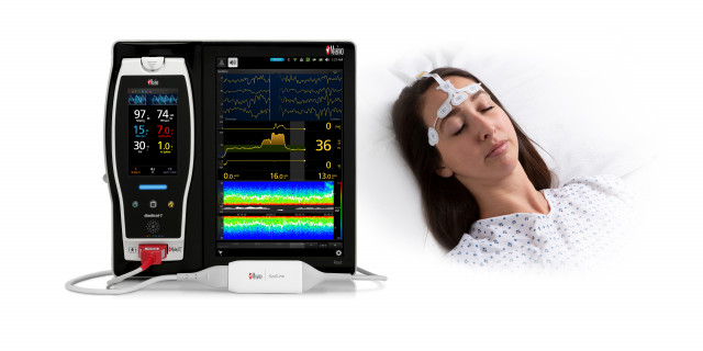 New Study Evaluates the Ability of Masimo SedLine® Brain Function Monitoring to Predict Neurological...