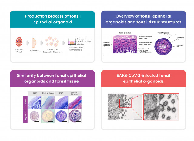 World’s-first tonsil epithelial organoids model for SARS-CoV-2 infection.