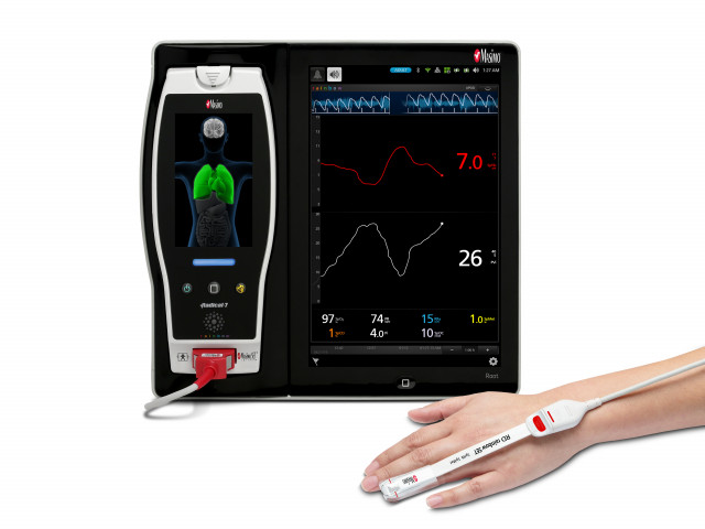 New Prospective Study Finds That Masimo SpHb® Noninvasive and Continuous Hemoglobin Monitoring Can H...