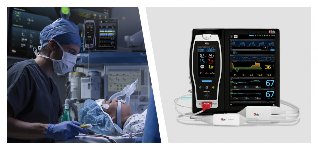 Researchers Harness the Power of Masimo Root®’s Advanced Multimodal Monitoring Capabilities to Study the Impact of Different Ventilatory Strategies on Brain Oxygenation During Thoracoscopic Surgery