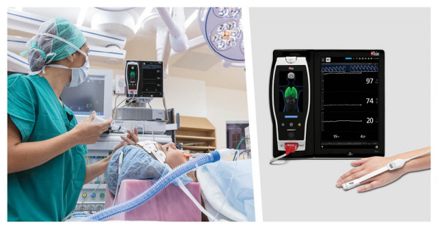 New Study Evaluates the Use of Masimo PVi® As an Indicator of Fluid Responsiveness to Guide Goal-Dir...