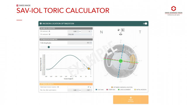 Launch of New Features, discover the unique Incision Location Optimization tool on SAV-IOL Toric Cal...