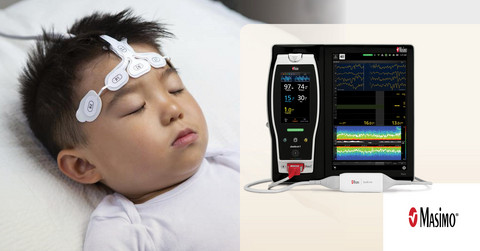 Masimo SedLine® Brain Function Monitoring