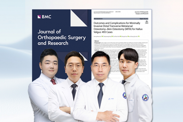 SNU서울병원 족부전담팀(서상교 대표원장, 이동오 원장, 강태병 원장, 이정환 원장)이 최소침습 무지외반증 수술(MITA)에 대한 연구 논문을 SCI급 국제학술지에 게재했다(사진=SNU서울병원)