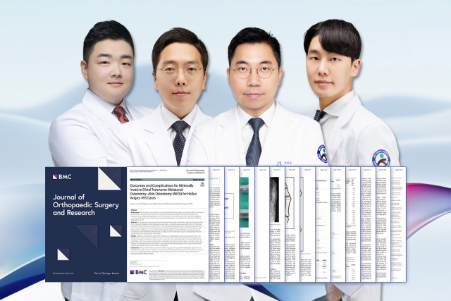 SNU서울병원 족부전담팀(서상교 대표원장, 이동오 원장, 강태병 원장, 이정환 원장)이 최소침습 무지외반증 수술(MITA)의 우수성을 입증하는 논문을 SCI급 국제학술지에 발표했다(사진=SNU서울병원)