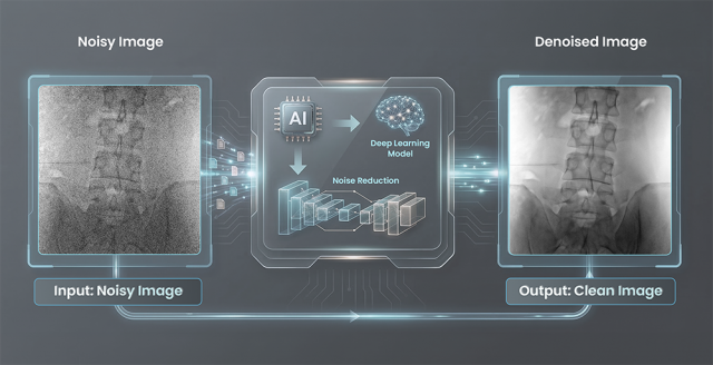 AI 기반 노이즈 제거로 선명한 영상 구현