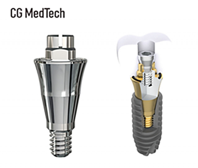 시지메드텍, 신제품 ‘우루덴트 SA’ 출시