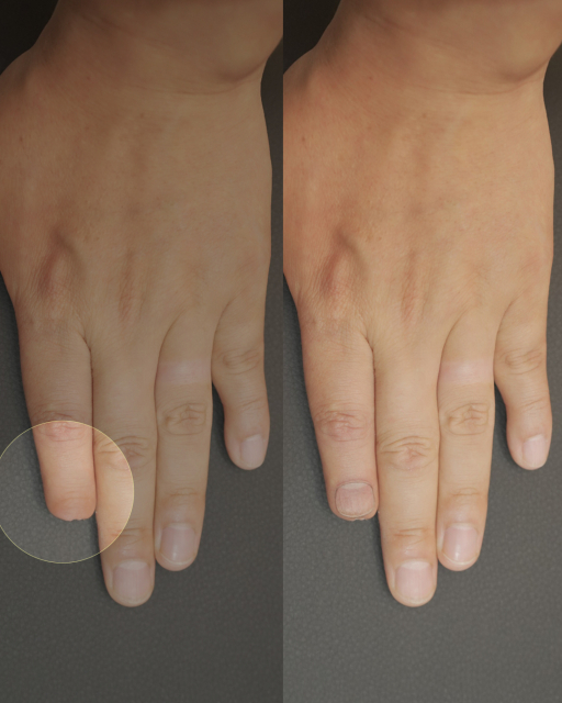 파라메디컬 타투, DOY(@tattooist_doy)