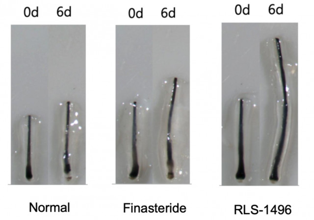 DHT 100 nM을 처리한 후 피나스테리드 600 nM(양성 대조군) 또는 RLS-1496 2000 nM을 투여하고, 0일과 6일에 관찰한 손상되지 않은 인간 모낭 생체외(ex vivo) 모델