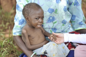 아프리카 말라위 지역의 한 아동이 말라리아 감염으로 신음하고 있다. 국제구호개발 NGO 굿