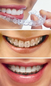 치아교정을 통해 건강과 심미성 두 가지 모두를 챙길 수 있다.