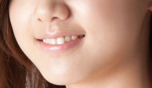 치아교정 시 발치를 결정하는 기준은 존재한다. 바로 악궁이 좁아서다.