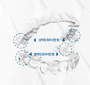인비절라인이 ‘MA(Mandibular Advancement, 맨디뷸러 어드밴스먼트)’를 출시했다